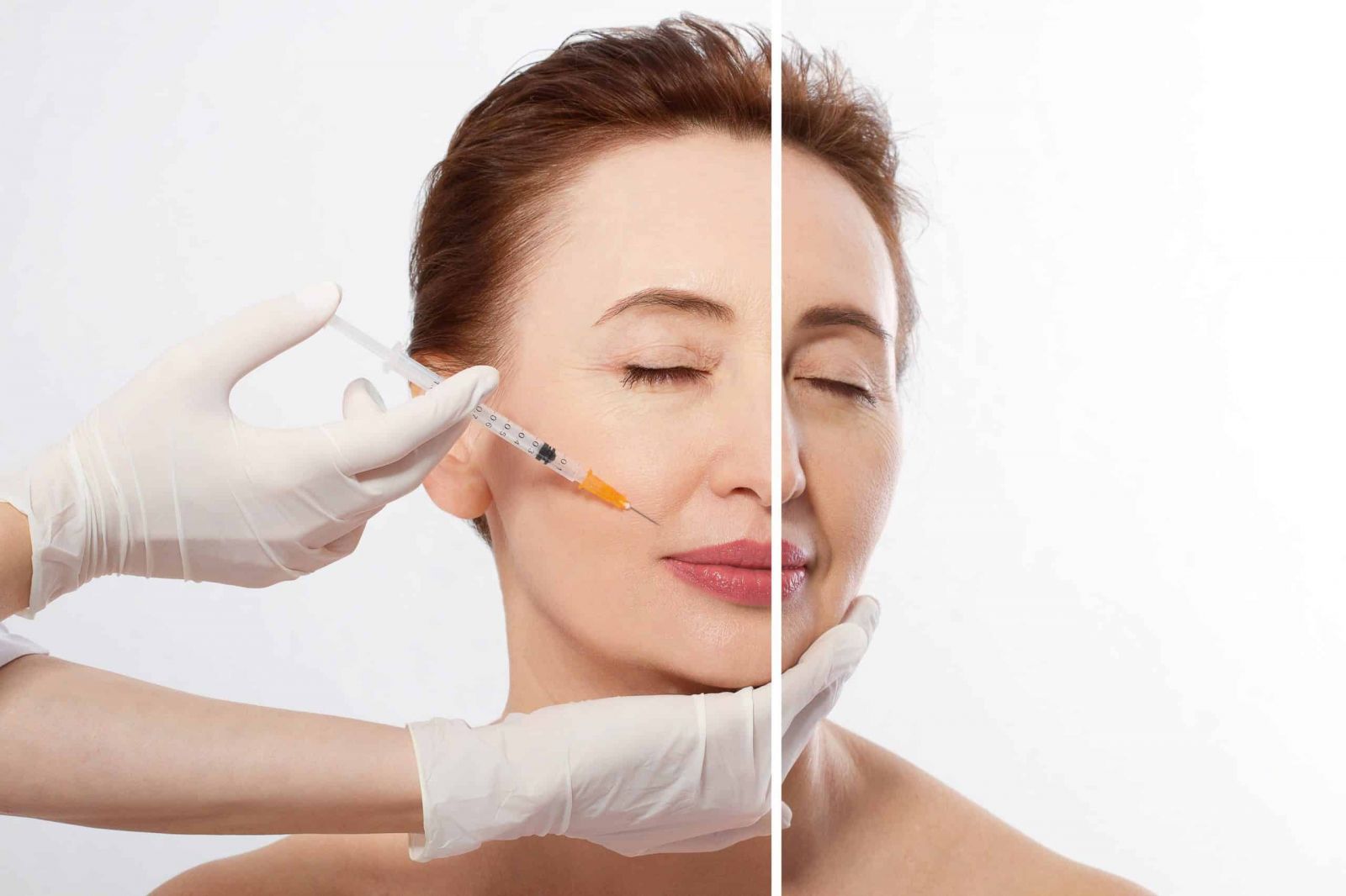TÌM HIỂU VỀ FILLER – THÀNH PHẦN, TÁC DỤNG, ƯU ĐIỂM