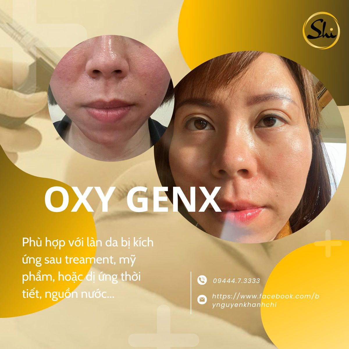 OXY GENX