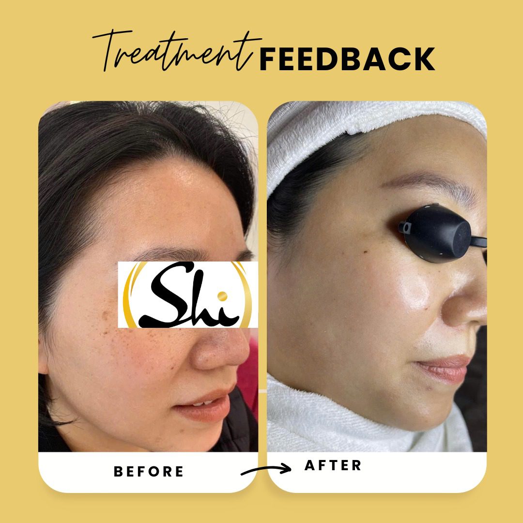 Feedback khách hàng