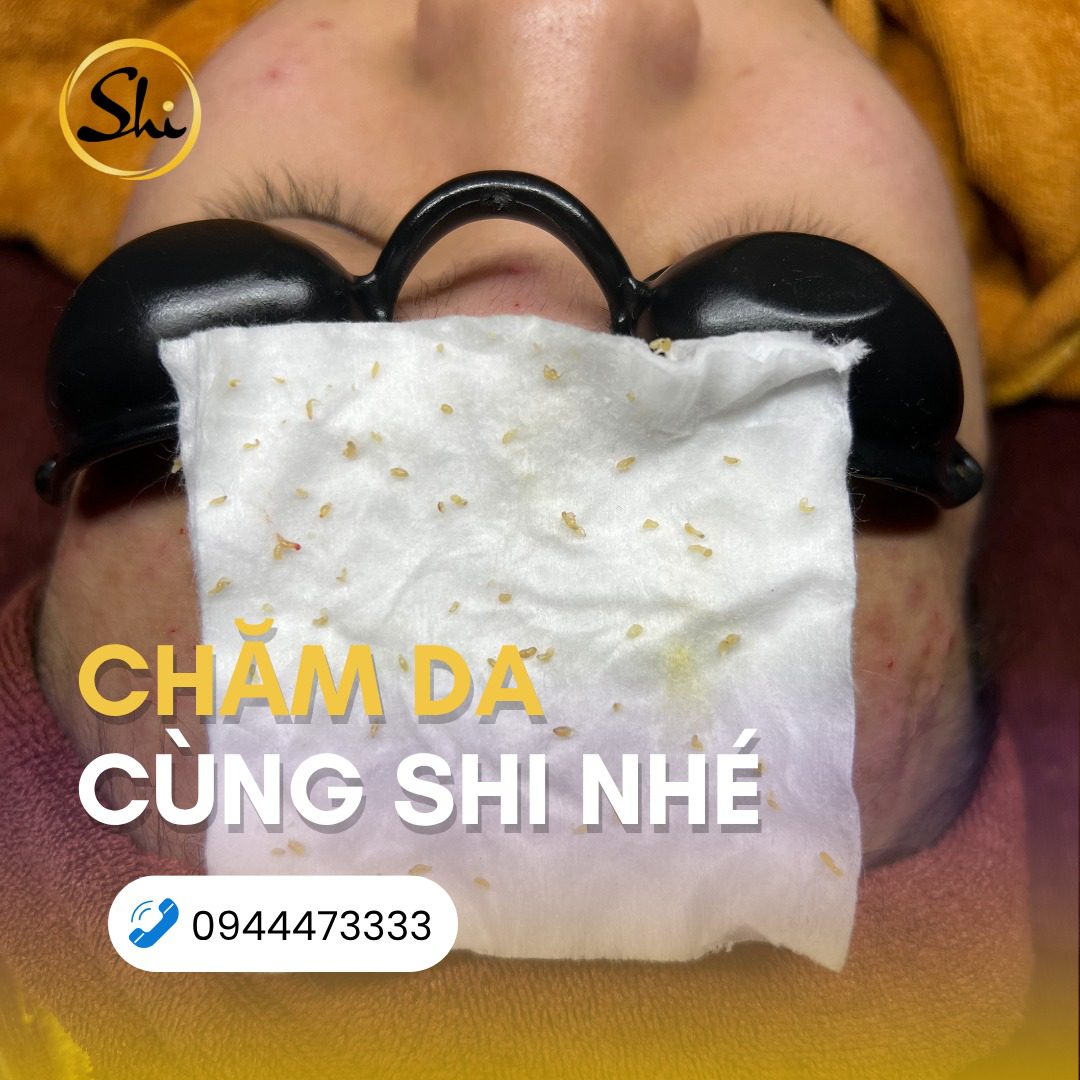 Chăm sóc da